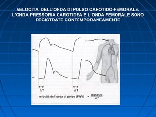 VELOCITA’ DELL’ONDA DI POLSO CAROTIDO-FEMORALE.
L’ONDA PRESSORIA CAROTIDEA E L’ONDA FEMORALE SONO
REGISTRATE CONTEMPORANEAMENTE
 