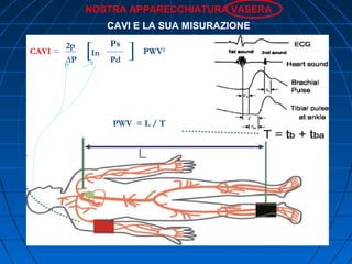 NOSTRA APPARECCHIATURA VASERA
CAVI E LA SUA MISURAZIONE
CAVI =
2р
∆P
[In
Ps
Pd
[
] PWV2
PWV = L / T
 