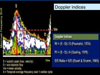 Doppler indices
 