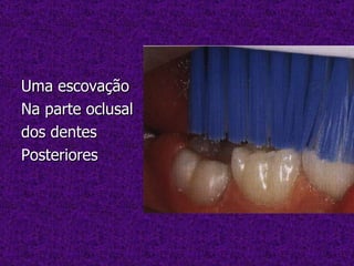 Uma escovação Na parte oclusal dos dentes Posteriores 