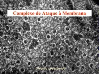Complexo de Ataque à Membrana Shigella dysenteriae 