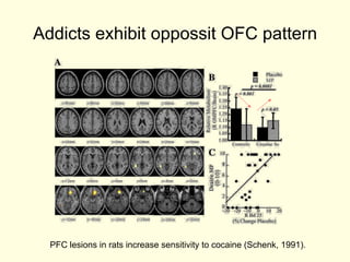 Addicts exhibit oppossit OFC pattern




  PFC lesions in rats increase sensitivity to cocaine (Schenk, 1991).
 