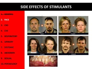 FACE 
• Acne 
• Dilated pupils 
• Blurred vision 
• Dry mouth and nose 
• Excessive grinding of teeth 
• Meth mouth 
• Dehydration 
1. GENERAL 
2. FACE 
3. CNS 
4. CVS 
5. RESPIRATORY 
6. URINARY 
7. SYSTEMIC 
8. ABDOMEN 
9. SEXUAL 
10. PSYCHOLOGY 
SIDE EFFECTS OF STIMULANTS 
 