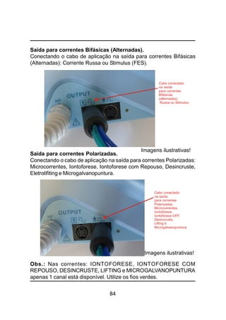 84
Saída para correntes Bifásicas (Alternadas).
Conectando o cabo de aplicação na saída para correntes Bifásicas
(Alternadas): Corrente Russa ou Stimulus (FES).
Saída para correntes Polarizadas.
Conectando o cabo de aplicação na saída para correntes Polarizadas:
Microcorrentes, Iontoforese, Iontoforese com Repouso, Desincruste,
Eletrolifiting e Microgalvanopuntura.
Obs.: Nas correntes: IONTOFORESE, IONTOFORESE COM
REPOUSO, DESINCRUSTE, LIFTING e MICROGALVANOPUNTURA
apenas 1 canal está disponível. Utilize os fios verdes.
Cabo conectado
na saída
para correntes
Bifásicas
(alternadas):
Russa ou Stimulus.
Cabo conectado
na saída
para correntes
Polarizadas:
Microcorrentes,
Iontoforese,
Iontoforese OFF,
Desincruste,
Lifting e
Microgalvanopuntura.
Imagens ilustrativas!
Imagens ilustrativas!
 