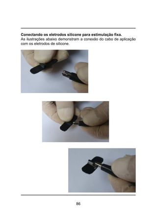 86
Conectando os eletrodos silicone para estimulação fixa.
As ilustrações abaixo demonstram a conexão do cabo de aplicação
com os eletrodos de silicone.
 