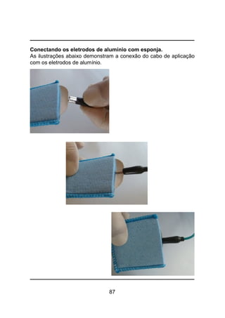 87
Conectando os eletrodos de alumínio com esponja.
As ilustrações abaixo demonstram a conexão do cabo de aplicação
com os eletrodos de alumínio.
 