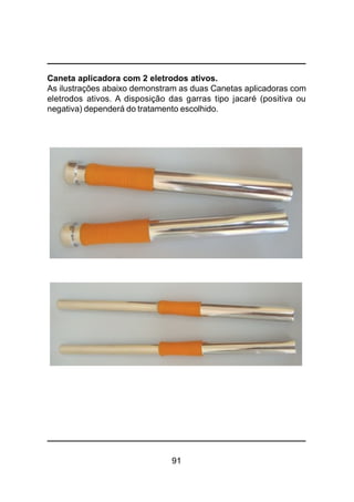 91
Caneta aplicadora com 2 eletrodos ativos.
As ilustrações abaixo demonstram as duas Canetas aplicadoras com
eletrodos ativos. A disposição das garras tipo jacaré (positiva ou
negativa) dependerá do tratamento escolhido.
 