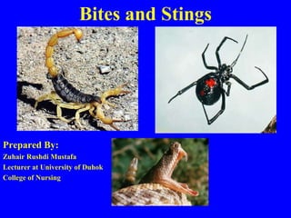 Bites and Stings
Prepared By:
Zuhair Rushdi Mustafa
Lecturer at University of Duhok
College of Nursing
 