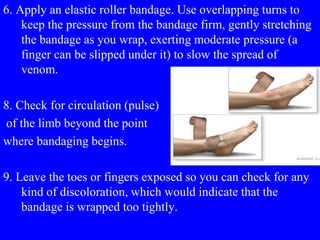 6. Apply an elastic roller bandage. Use overlapping turns to
keep the pressure from the bandage firm, gently stretching
the bandage as you wrap, exerting moderate pressure (a
finger can be slipped under it) to slow the spread of
venom.
8. Check for circulation (pulse)
of the limb beyond the point
where bandaging begins.
9. Leave the toes or fingers exposed so you can check for any
kind of discoloration, which would indicate that the
bandage is wrapped too tightly.
 
