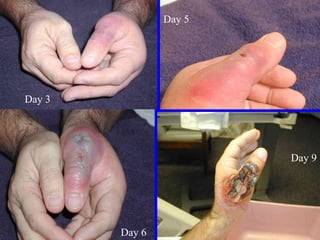 Day 3
Day 5
Day 9
Day 6
 