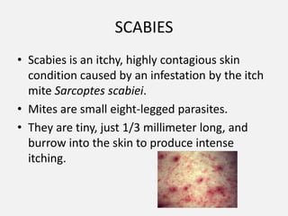 Rarely acquired through unprotected sexSYMPTOMS:Some people show no symptoms at firstOthers can experience flu-like symptomsJaundice or a darkening of the urineFatigue Testing for Hep C involves a blood test. A test can give a negative result for several months after infection, so a second follow up test needs to be done. 
