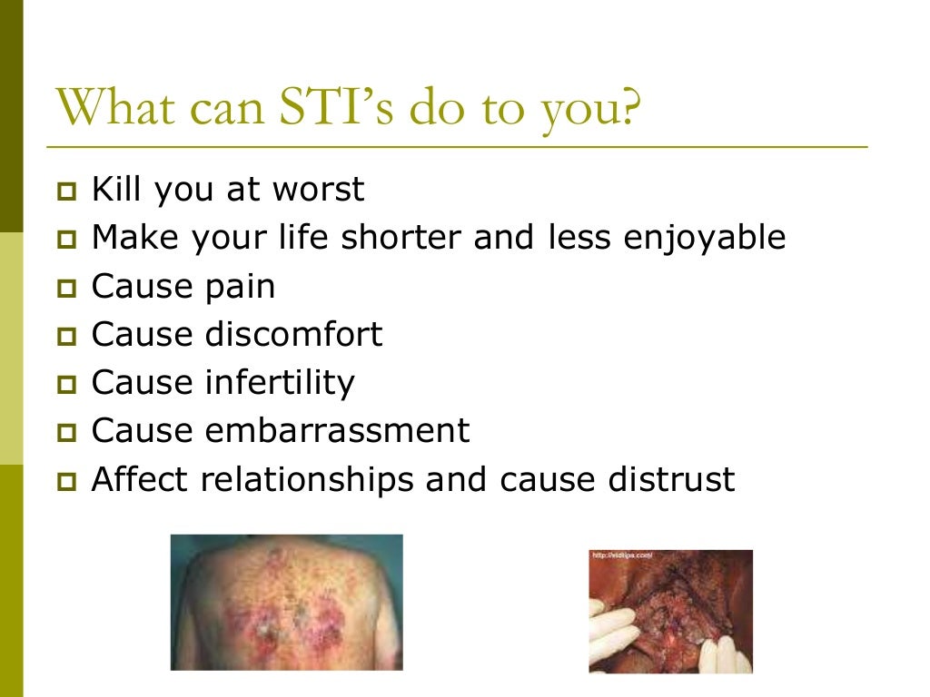Sti's updated-What you need to know