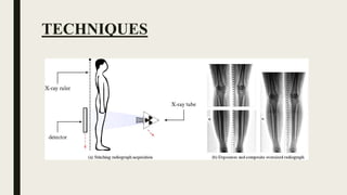 STITCH RADIOGRAPHY TECHNIQUES AND METHODS.pptx
