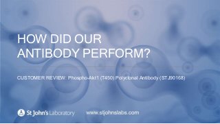 HOW DID OUR
ANTIBODY PERFORM?
CUSTOMER REVIEW: Phospho-Akt1 (T450) Polyclonal Antibody (STJ90168)
 