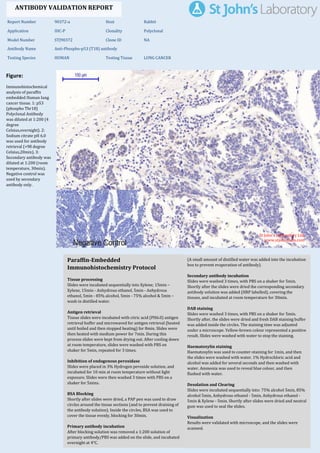 Figure:
Immunohistochemical
analysis of paraffin
embedded Human lung
cancer tissue. 1: p53
(phospho Thr18)
Polyclonal Antibody
was diluted at 1:200 (4
degree
Celsius,overnight). 2:
Sodium citrate pH 6.0
was used for antibody
retrieval (>98 degree
Celsius,20min). 3:
Secondary antibody was
diluted at 1:200 (room
temperature, 30min).
Negative control was
used by secondary
antibody only.
Report Number 90372-a Host Rabbit
Application IHC-P Clonality Polyclonal
Model Number STJ90372 Clone ID NA
Antibody Name Anti-Phospho-p53 (T18) antibody
Testing Species HUMAN Testing Tissue LUNG CANCER
ANTIBODY VALIDATION REPORT
b. (A small amount of distilled water was added into the incubation
box to prevent evaporation of antibody).
8. Secondary antibody incubation
a. Slides were washed 3 times, with PBS on a shaker for 5min.
Shortly after the slides were dried the corresponding secondary
antibody solution was added (HRP labelled), covering the
tissues, and incubated at room temperature for 30min.
b.
9. DAB staining
a. Slides were washed 3 times, with PBS on a shaker for 5min.
b. Shortly after, the slides were dried and fresh DAB staining buffer
was added inside the circles. The staining time was adjusted
under a microscope. Yellow-brown colour represented a positive
result. Slides were washed with water to stop the staining.
c.
10. Haematoxylin staining
a. Haematoxylin was used to counter-staining for 1min, and then
the slides were washed with water. 1% Hydrochloric acid and
alcohol was added for several seconds and then washed with
water. Ammonia was used to reveal blue colour, and then
flushed with water.
b.
11. Desolation and Clearing
i. Slides were incubated sequentially into: 75% alcohol 5min, 85%
alcohol 5min, Anhydrous ethanol - 5min, Anhydrous ethanol -
5min & Xylene - 5min. Shortly after slides were dried and neutral
gum was used to seal the slides.
ii.
12. Visualization
a. Results were validated with microscope, and the slides were
scanned.
Paraffin-Embedded
Immunohistochemistry Protocol
2.
3. Tissue processing
a. Slides were incubated sequentially into Xylene; 15min –
Xylene, 15min - Anhydrous ethanol, 5min - Anhydrous
ethanol, 5min - 85% alcohol, 5min - 75% alcohol & 5min –
wash in distilled water.
b.
4. Antigen retrieval
a. Tissue slides were incubated with citric acid (PH6.0) antigen
retrieval buffer and microwaved for antigen retrieval (heated
until boiled and then stopped heating) for 8min. Slides were
then heated with medium power for 7min. During this
process slides were kept from drying out. After cooling down
at room temperature, slides were washed with PBS on
shaker for 5min, repeated for 3 times.
b.
5. Inhibition of endogenous peroxidase
a. Slides were placed in 3% Hydrogen peroxide solution, and
incubated for 10 min at room temperature without light
exposure. Slides were then washed 3 times with PBS on a
shaker for 5mins.
b.
6. BSA Blocking
a. Shortly after slides were dried, a PAP pen was used to draw
circles around the tissue sections (and to prevent draining of
the antibody solution). Inside the circles, BSA was used to
cover the tissue evenly, blocking for 30min.
b.
7. Primary antibody incubation
After blocking solution was removed a 1:200 solution of
primary antibody/PBS was added on the slide, and incubated
overnight at 4°C.
St John's Laboratory Ltd.
www.stjohnslabs.com
 