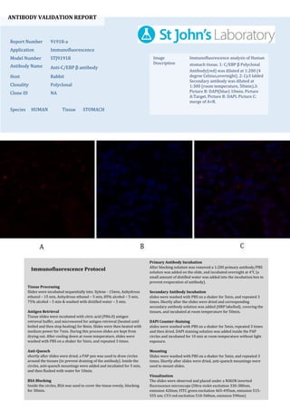 ANTIBODY VALIDATION REPORT
Report Number 91918-a
Application Immunofluorescence
Model Number STJ91918
Antibody Name Anti-C/EBP β antibody
Host Rabbit
Clonality Polyclonal
Clone ID NA
Species HUMAN Tissue STOMACH
Image
Description
Immunofluorescence analysis of Human
stomach tissue. 1: C/EBP β Polyclonal
Antibody(red) was diluted at 1:200 (4
degree Celsius,overnight). 2: Cy3 labled
Secondary antibody was diluted at
1:300 (room temperature, 50min).3:
Picture B: DAPI(blue) 10min. Picture
A:Target. Picture B: DAPI. Picture C:
merge of A+B.
Primary Antibody Incubation
After blocking solution was removed a 1:200 primary antibody/PBS
solution was added on the slide, and incubated overnight at 4°C (a
small amount of distilled water was added into the incubation box to
prevent evaporation of antibody).
Secondary Antibody Incubation
slides were washed with PBS on a shaker for 5min, and repeated 3
times. Shortly after the slides were dried and corresponding
secondary antibody solution was added (HRP labelled), covering the
tissues, and incubated at room temperature for 50min.
DAPI Counter-Staining
slides were washed with PBS on a shaker for 5min, repeated 3 times
and then dried. DAPI staining solution was added inside the PAP
circles and incubated for 10 min at room temperature without light
exposure.
Mounting
Slides were washed with PBS on a shaker for 5min, and repeated 3
times. Shortly after slides were dried, anti-quench mountings were
used to mount slides.
Visualization
The slides were observed and placed under a NIKON inverted
fluorescence microscope (Ultra violet excitation 330-380nm,
emission 420nm; FITC green excitation 465-495nm, emission 515-
555 nm; CY3 red excitation 510-560nm, emission 590nm)
Immunofluorescence Protocol
Tissue Processing
Slides were incubated sequentially into: Xylene - 15min, Anhydrous
ethanol – 15 min, Anhydrous ethanol – 5 min, 85% alcohol – 5 min,
75% alcohol – 5 min & washed with distilled water – 5 min.
Antigen Retrieval
Tissue slides were incubated with citric acid (PH6.0) antigen
retrieval buffer, and microwaved for antigen retrieval (heated until
boiled and then stop heating) for 8min. Slides were then heated with
medium power for 7min. During this process slides are kept from
drying out. After cooling down at room temperature, slides were
washed with PBS on a shaker for 5min, and repeated 3 times.
Anti-Quench
shortly after slides were dried, a PAP pen was used to draw circles
around the tissues (to prevent draining of the antibody). Inside the
circles, anti-quench mountings were added and incubated for 5 min,
and then flushed with water for 10min.
BSA Blocking
Inside the circles, BSA was used to cover the tissue evenly, blocking
for 30min.
 