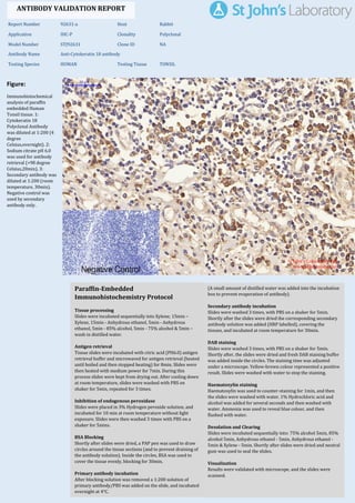 Figure:
Immunohistochemical
analysis of paraffin
embedded Human
Tonsil tissue. 1:
Cytokeratin 18
Polyclonal Antibody
was diluted at 1:200 (4
degree
Celsius,overnight). 2:
Sodium citrate pH 6.0
was used for antibody
retrieval (>98 degree
Celsius,20min). 3:
Secondary antibody was
diluted at 1:200 (room
temperature, 30min).
Negative control was
used by secondary
antibody only.
Report Number 92631-a Host Rabbit
Application IHC-P Clonality Polyclonal
Model Number STJ92631 Clone ID NA
Antibody Name Anti-Cytokeratin 18 antibody
Testing Species HUMAN Testing Tissue TONSIL
ANTIBODY VALIDATION REPORT
a. (A small amount of distilled water was added into the incubation
box to prevent evaporation of antibody).
18. Secondary antibody incubation
a. Slides were washed 3 times, with PBS on a shaker for 5min.
Shortly after the slides were dried the corresponding secondary
antibody solution was added (HRP labelled), covering the
tissues, and incubated at room temperature for 30min.
b.
19. DAB staining
a. Slides were washed 3 times, with PBS on a shaker for 5min.
b. Shortly after, the slides were dried and fresh DAB staining buffer
was added inside the circles. The staining time was adjusted
under a microscope. Yellow-brown colour represented a positive
result. Slides were washed with water to stop the staining.
c.
20. Haematoxylin staining
a. Haematoxylin was used to counter-staining for 1min, and then
the slides were washed with water. 1% Hydrochloric acid and
alcohol was added for several seconds and then washed with
water. Ammonia was used to reveal blue colour, and then
flushed with water.
b.
21. Desolation and Clearing
i. Slides were incubated sequentially into: 75% alcohol 5min, 85%
alcohol 5min, Anhydrous ethanol - 5min, Anhydrous ethanol -
5min & Xylene - 5min. Shortly after slides were dried and neutral
gum was used to seal the slides.
ii.
22. Visualization
a. Results were validated with microscope, and the slides were
scanned.
Paraffin-Embedded
Immunohistochemistry Protocol
12.
13. Tissue processing
a. Slides were incubated sequentially into Xylene; 15min –
Xylene, 15min - Anhydrous ethanol, 5min - Anhydrous
ethanol, 5min - 85% alcohol, 5min - 75% alcohol & 5min –
wash in distilled water.
b.
14. Antigen retrieval
a. Tissue slides were incubated with citric acid (PH6.0) antigen
retrieval buffer and microwaved for antigen retrieval (heated
until boiled and then stopped heating) for 8min. Slides were
then heated with medium power for 7min. During this
process slides were kept from drying out. After cooling down
at room temperature, slides were washed with PBS on
shaker for 5min, repeated for 3 times.
b.
15. Inhibition of endogenous peroxidase
a. Slides were placed in 3% Hydrogen peroxide solution, and
incubated for 10 min at room temperature without light
exposure. Slides were then washed 3 times with PBS on a
shaker for 5mins.
b.
16. BSA Blocking
a. Shortly after slides were dried, a PAP pen was used to draw
circles around the tissue sections (and to prevent draining of
the antibody solution). Inside the circles, BSA was used to
cover the tissue evenly, blocking for 30min.
b.
17. Primary antibody incubation
After blocking solution was removed a 1:200 solution of
primary antibody/PBS was added on the slide, and incubated
overnight at 4°C.
St John's Laboratory Ltd.
www.stjohnslabs.com
 
