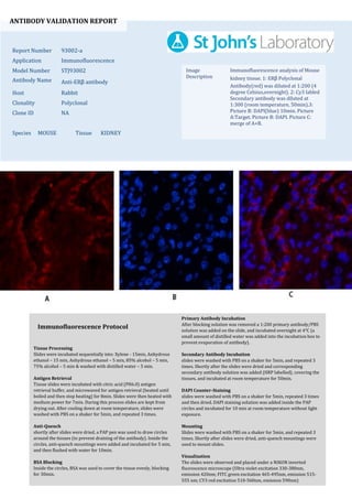 ANTIBODY VALIDATION REPORT
Report Number 93002-a
Application Immunofluorescence
Model Number STJ93002
Antibody Name Anti-ERβ antibody
Host Rabbit
Clonality Polyclonal
Clone ID NA
Species MOUSE Tissue KIDNEY
Image
Description
Immunofluorescence analysis of Mouse
kidney tissue. 1: ERβ Polyclonal
Antibody(red) was diluted at 1:200 (4
degree Celsius,overnight). 2: Cy3 labled
Secondary antibody was diluted at
1:300 (room temperature, 50min).3:
Picture B: DAPI(blue) 10min. Picture
A:Target. Picture B: DAPI. Picture C:
merge of A+B.
Primary Antibody Incubation
After blocking solution was removed a 1:200 primary antibody/PBS
solution was added on the slide, and incubated overnight at 4°C (a
small amount of distilled water was added into the incubation box to
prevent evaporation of antibody).
Secondary Antibody Incubation
slides were washed with PBS on a shaker for 5min, and repeated 3
times. Shortly after the slides were dried and corresponding
secondary antibody solution was added (HRP labelled), covering the
tissues, and incubated at room temperature for 50min.
DAPI Counter-Staining
slides were washed with PBS on a shaker for 5min, repeated 3 times
and then dried. DAPI staining solution was added inside the PAP
circles and incubated for 10 min at room temperature without light
exposure.
Mounting
Slides were washed with PBS on a shaker for 5min, and repeated 3
times. Shortly after slides were dried, anti-quench mountings were
used to mount slides.
Visualization
The slides were observed and placed under a NIKON inverted
fluorescence microscope (Ultra violet excitation 330-380nm,
emission 420nm; FITC green excitation 465-495nm, emission 515-
555 nm; CY3 red excitation 510-560nm, emission 590nm)
Immunofluorescence Protocol
Tissue Processing
Slides were incubated sequentially into: Xylene - 15min, Anhydrous
ethanol – 15 min, Anhydrous ethanol – 5 min, 85% alcohol – 5 min,
75% alcohol – 5 min & washed with distilled water – 5 min.
Antigen Retrieval
Tissue slides were incubated with citric acid (PH6.0) antigen
retrieval buffer, and microwaved for antigen retrieval (heated until
boiled and then stop heating) for 8min. Slides were then heated with
medium power for 7min. During this process slides are kept from
drying out. After cooling down at room temperature, slides were
washed with PBS on a shaker for 5min, and repeated 3 times.
Anti-Quench
shortly after slides were dried, a PAP pen was used to draw circles
around the tissues (to prevent draining of the antibody). Inside the
circles, anti-quench mountings were added and incubated for 5 min,
and then flushed with water for 10min.
BSA Blocking
Inside the circles, BSA was used to cover the tissue evenly, blocking
for 30min.
 