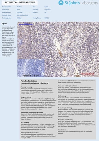 Figure:
Immunohistochemical
analysis of paraffin
embedded Human
Tonsil tissue. 1: Glut1
Polyclonal Antibody
was diluted at 1:200 (4
degree
Celsius,overnight). 2:
Sodium citrate pH 6.0
was used for antibody
retrieval (>98 degree
Celsius,20min). 3:
Secondary antibody was
diluted at 1:200 (room
temperature, 30min).
Negative control was
used by secondary
antibody only.
Report Number 93293-a Host Rabbit
Application IHC-P Clonality Polyclonal
Model Number STJ93293 Clone ID NA
Antibody Name Anti-Glut1 antibody
Testing Species HUMAN Testing Tissue TONSIL
ANTIBODY VALIDATION REPORT
a. (A small amount of distilled water was added into the incubation
box to prevent evaporation of antibody).
73. Secondary antibody incubation
a. Slides were washed 3 times, with PBS on a shaker for 5min.
Shortly after the slides were dried the corresponding secondary
antibody solution was added (HRP labelled), covering the
tissues, and incubated at room temperature for 30min.
b.
74. DAB staining
a. Slides were washed 3 times, with PBS on a shaker for 5min.
b. Shortly after, the slides were dried and fresh DAB staining buffer
was added inside the circles. The staining time was adjusted
under a microscope. Yellow-brown colour represented a positive
result. Slides were washed with water to stop the staining.
c.
75. Haematoxylin staining
a. Haematoxylin was used to counter-staining for 1min, and then
the slides were washed with water. 1% Hydrochloric acid and
alcohol was added for several seconds and then washed with
water. Ammonia was used to reveal blue colour, and then
flushed with water.
b.
76. Desolation and Clearing
i. Slides were incubated sequentially into: 75% alcohol 5min, 85%
alcohol 5min, Anhydrous ethanol - 5min, Anhydrous ethanol -
5min & Xylene - 5min. Shortly after slides were dried and neutral
gum was used to seal the slides.
ii.
77. Visualization
a. Results were validated with microscope, and the slides were
scanned.
Paraffin-Embedded
Immunohistochemistry Protocol
67.
68. Tissue processing
a. Slides were incubated sequentially into Xylene; 15min –
Xylene, 15min - Anhydrous ethanol, 5min - Anhydrous
ethanol, 5min - 85% alcohol, 5min - 75% alcohol & 5min –
wash in distilled water.
b.
69. Antigen retrieval
a. Tissue slides were incubated with citric acid (PH6.0) antigen
retrieval buffer and microwaved for antigen retrieval (heated
until boiled and then stopped heating) for 8min. Slides were
then heated with medium power for 7min. During this
process slides were kept from drying out. After cooling down
at room temperature, slides were washed with PBS on
shaker for 5min, repeated for 3 times.
b.
70. Inhibition of endogenous peroxidase
a. Slides were placed in 3% Hydrogen peroxide solution, and
incubated for 10 min at room temperature without light
exposure. Slides were then washed 3 times with PBS on a
shaker for 5mins.
b.
71. BSA Blocking
a. Shortly after slides were dried, a PAP pen was used to draw
circles around the tissue sections (and to prevent draining of
the antibody solution). Inside the circles, BSA was used to
cover the tissue evenly, blocking for 30min.
b.
72. Primary antibody incubation
After blocking solution was removed a 1:200 solution of
primary antibody/PBS was added on the slide, and incubated
overnight at 4°C.
St John's Laboratory Ltd.
www.stjohnslabs.com
 