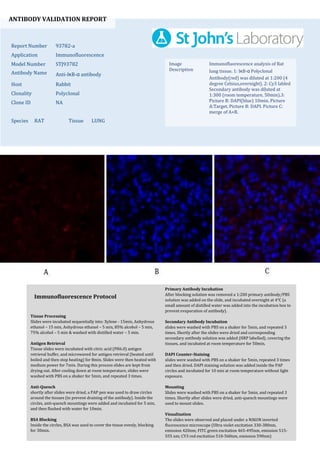 ANTIBODY VALIDATION REPORT
Report Number 93782-a
Application Immunofluorescence
Model Number STJ93782
Antibody Name Anti-IκB-α antibody
Host Rabbit
Clonality Polyclonal
Clone ID NA
Species RAT Tissue LUNG
Image
Description
Immunofluorescence analysis of Rat
lung tissue. 1: IκB-α Polyclonal
Antibody(red) was diluted at 1:200 (4
degree Celsius,overnight). 2: Cy3 labled
Secondary antibody was diluted at
1:300 (room temperature, 50min).3:
Picture B: DAPI(blue) 10min. Picture
A:Target. Picture B: DAPI. Picture C:
merge of A+B.
Primary Antibody Incubation
After blocking solution was removed a 1:200 primary antibody/PBS
solution was added on the slide, and incubated overnight at 4°C (a
small amount of distilled water was added into the incubation box to
prevent evaporation of antibody).
Secondary Antibody Incubation
slides were washed with PBS on a shaker for 5min, and repeated 3
times. Shortly after the slides were dried and corresponding
secondary antibody solution was added (HRP labelled), covering the
tissues, and incubated at room temperature for 50min.
DAPI Counter-Staining
slides were washed with PBS on a shaker for 5min, repeated 3 times
and then dried. DAPI staining solution was added inside the PAP
circles and incubated for 10 min at room temperature without light
exposure.
Mounting
Slides were washed with PBS on a shaker for 5min, and repeated 3
times. Shortly after slides were dried, anti-quench mountings were
used to mount slides.
Visualization
The slides were observed and placed under a NIKON inverted
fluorescence microscope (Ultra violet excitation 330-380nm,
emission 420nm; FITC green excitation 465-495nm, emission 515-
555 nm; CY3 red excitation 510-560nm, emission 590nm)
Immunofluorescence Protocol
Tissue Processing
Slides were incubated sequentially into: Xylene - 15min, Anhydrous
ethanol – 15 min, Anhydrous ethanol – 5 min, 85% alcohol – 5 min,
75% alcohol – 5 min & washed with distilled water – 5 min.
Antigen Retrieval
Tissue slides were incubated with citric acid (PH6.0) antigen
retrieval buffer, and microwaved for antigen retrieval (heated until
boiled and then stop heating) for 8min. Slides were then heated with
medium power for 7min. During this process slides are kept from
drying out. After cooling down at room temperature, slides were
washed with PBS on a shaker for 5min, and repeated 3 times.
Anti-Quench
shortly after slides were dried, a PAP pen was used to draw circles
around the tissues (to prevent draining of the antibody). Inside the
circles, anti-quench mountings were added and incubated for 5 min,
and then flushed with water for 10min.
BSA Blocking
Inside the circles, BSA was used to cover the tissue evenly, blocking
for 30min.
 