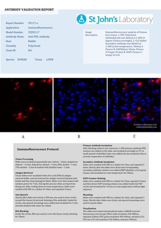 ANTIBODY VALIDATION REPORT
Report Number 95117-a
Application Immunofluorescence
Model Number STJ95117
Antibody Name Anti-PKC antibody
Host Rabbit
Clonality Polyclonal
Clone ID NA
Species HUMAN Tissue LIVER
Image
Description
Immunofluorescence analysis of Human
liver tissue. 1: PKC Polyclonal
Antibody(red) was diluted at 1:200 (4
degree Celsius,overnight). 2: Cy3 labled
Secondary antibody was diluted at
1:300 (room temperature, 50min).3:
Picture B: DAPI(blue) 10min. Picture
A:Target. Picture B: DAPI. Picture C:
merge of A+B.
Primary Antibody Incubation
After blocking solution was removed a 1:200 primary antibody/PBS
solution was added on the slide, and incubated overnight at 4°C (a
small amount of distilled water was added into the incubation box to
prevent evaporation of antibody).
Secondary Antibody Incubation
slides were washed with PBS on a shaker for 5min, and repeated 3
times. Shortly after the slides were dried and corresponding
secondary antibody solution was added (HRP labelled), covering the
tissues, and incubated at room temperature for 50min.
DAPI Counter-Staining
slides were washed with PBS on a shaker for 5min, repeated 3 times
and then dried. DAPI staining solution was added inside the PAP
circles and incubated for 10 min at room temperature without light
exposure.
Mounting
Slides were washed with PBS on a shaker for 5min, and repeated 3
times. Shortly after slides were dried, anti-quench mountings were
used to mount slides.
Visualization
The slides were observed and placed under a NIKON inverted
fluorescence microscope (Ultra violet excitation 330-380nm,
emission 420nm; FITC green excitation 465-495nm, emission 515-
555 nm; CY3 red excitation 510-560nm, emission 590nm)
Immunofluorescence Protocol
Tissue Processing
Slides were incubated sequentially into: Xylene - 15min, Anhydrous
ethanol – 15 min, Anhydrous ethanol – 5 min, 85% alcohol – 5 min,
75% alcohol – 5 min & washed with distilled water – 5 min.
Antigen Retrieval
Tissue slides were incubated with citric acid (PH6.0) antigen
retrieval buffer, and microwaved for antigen retrieval (heated until
boiled and then stop heating) for 8min. Slides were then heated with
medium power for 7min. During this process slides are kept from
drying out. After cooling down at room temperature, slides were
washed with PBS on a shaker for 5min, and repeated 3 times.
Anti-Quench
shortly after slides were dried, a PAP pen was used to draw circles
around the tissues (to prevent draining of the antibody). Inside the
circles, anti-quench mountings were added and incubated for 5 min,
and then flushed with water for 10min.
BSA Blocking
Inside the circles, BSA was used to cover the tissue evenly, blocking
for 30min.
St John's Laboratory Ltd.
www.stjohnslabs.com
 