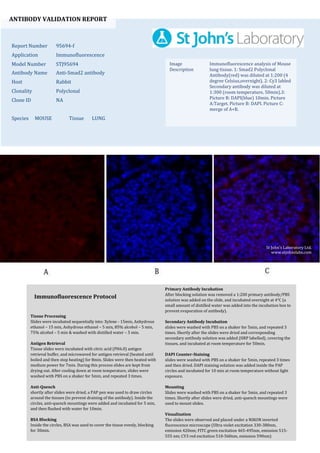 ANTIBODY VALIDATION REPORT
Report Number 95694-f
Application Immunofluorescence
Model Number STJ95694
Antibody Name Anti-Smad2 antibody
Host Rabbit
Clonality Polyclonal
Clone ID NA
Species MOUSE Tissue LUNG
Image
Description
Immunofluorescence analysis of Mouse
lung tissue. 1: Smad2 Polyclonal
Antibody(red) was diluted at 1:200 (4
degree Celsius,overnight). 2: Cy3 labled
Secondary antibody was diluted at
1:300 (room temperature, 50min).3:
Picture B: DAPI(blue) 10min. Picture
A:Target. Picture B: DAPI. Picture C:
merge of A+B.
Primary Antibody Incubation
After blocking solution was removed a 1:200 primary antibody/PBS
solution was added on the slide, and incubated overnight at 4°C (a
small amount of distilled water was added into the incubation box to
prevent evaporation of antibody).
Secondary Antibody Incubation
slides were washed with PBS on a shaker for 5min, and repeated 3
times. Shortly after the slides were dried and corresponding
secondary antibody solution was added (HRP labelled), covering the
tissues, and incubated at room temperature for 50min.
DAPI Counter-Staining
slides were washed with PBS on a shaker for 5min, repeated 3 times
and then dried. DAPI staining solution was added inside the PAP
circles and incubated for 10 min at room temperature without light
exposure.
Mounting
Slides were washed with PBS on a shaker for 5min, and repeated 3
times. Shortly after slides were dried, anti-quench mountings were
used to mount slides.
Visualization
The slides were observed and placed under a NIKON inverted
fluorescence microscope (Ultra violet excitation 330-380nm,
emission 420nm; FITC green excitation 465-495nm, emission 515-
555 nm; CY3 red excitation 510-560nm, emission 590nm)
Immunofluorescence Protocol
Tissue Processing
Slides were incubated sequentially into: Xylene - 15min, Anhydrous
ethanol – 15 min, Anhydrous ethanol – 5 min, 85% alcohol – 5 min,
75% alcohol – 5 min & washed with distilled water – 5 min.
Antigen Retrieval
Tissue slides were incubated with citric acid (PH6.0) antigen
retrieval buffer, and microwaved for antigen retrieval (heated until
boiled and then stop heating) for 8min. Slides were then heated with
medium power for 7min. During this process slides are kept from
drying out. After cooling down at room temperature, slides were
washed with PBS on a shaker for 5min, and repeated 3 times.
Anti-Quench
shortly after slides were dried, a PAP pen was used to draw circles
around the tissues (to prevent draining of the antibody). Inside the
circles, anti-quench mountings were added and incubated for 5 min,
and then flushed with water for 10min.
BSA Blocking
Inside the circles, BSA was used to cover the tissue evenly, blocking
for 30min.
St John's Laboratory Ltd.
www.stjohnslabs.com
 