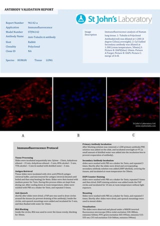ANTIBODY VALIDATION REPORT
Report Number 96142-a
Application Immunofluorescence
Model Number STJ96142
Antibody Name Anti-Tubulin α antibody
Host Rabbit
Clonality Polyclonal
Clone ID NA
Species HUMAN Tissue LUNG
Image
Description
Immunofluorescence analysis of Human
lung tissue. 1: Tubulin α Polyclonal
Antibody(red) was diluted at 1:200 (4
degree Celsius,overnight). 2: Cy3 labled
Secondary antibody was diluted at
1:300 (room temperature, 50min).3:
Picture B: DAPI(blue) 10min. Picture
A:Target. Picture B: DAPI. Picture C:
merge of A+B.
Primary Antibody Incubation
After blocking solution was removed a 1:200 primary antibody/PBS
solution was added on the slide, and incubated overnight at 4°C (a
small amount of distilled water was added into the incubation box to
prevent evaporation of antibody).
Secondary Antibody Incubation
slides were washed with PBS on a shaker for 5min, and repeated 3
times. Shortly after the slides were dried and corresponding
secondary antibody solution was added (HRP labelled), covering the
tissues, and incubated at room temperature for 50min.
DAPI Counter-Staining
slides were washed with PBS on a shaker for 5min, repeated 3 times
and then dried. DAPI staining solution was added inside the PAP
circles and incubated for 10 min at room temperature without light
exposure.
Mounting
Slides were washed with PBS on a shaker for 5min, and repeated 3
times. Shortly after slides were dried, anti-quench mountings were
used to mount slides.
Visualization
The slides were observed and placed under a NIKON inverted
fluorescence microscope (Ultra violet excitation 330-380nm,
emission 420nm; FITC green excitation 465-495nm, emission 515-
555 nm; CY3 red excitation 510-560nm, emission 590nm)
Immunofluorescence Protocol
Tissue Processing
Slides were incubated sequentially into: Xylene - 15min, Anhydrous
ethanol – 15 min, Anhydrous ethanol – 5 min, 85% alcohol – 5 min,
75% alcohol – 5 min & washed with distilled water – 5 min.
Antigen Retrieval
Tissue slides were incubated with citric acid (PH6.0) antigen
retrieval buffer, and microwaved for antigen retrieval (heated until
boiled and then stop heating) for 8min. Slides were then heated with
medium power for 7min. During this process slides are kept from
drying out. After cooling down at room temperature, slides were
washed with PBS on a shaker for 5min, and repeated 3 times.
Anti-Quench
shortly after slides were dried, a PAP pen was used to draw circles
around the tissues (to prevent draining of the antibody). Inside the
circles, anti-quench mountings were added and incubated for 5 min,
and then flushed with water for 10min.
BSA Blocking
Inside the circles, BSA was used to cover the tissue evenly, blocking
for 30min.
St John's Laboratory Ltd.
www.stjohnslabs.com
 