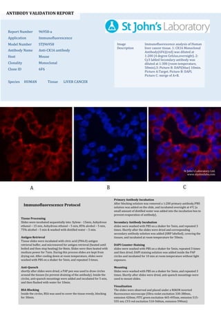 ANTIBODY VALIDATION REPORT
Report Number 96958-a
Application Immunofluorescence
Model Number STJ96958
Antibody Name Anti-CK16 antibody
Host Mouse
Clonality Monoclonal
Clone ID 6F6
Species HUMAN Tissue LIVER CANCER
Image
Description
Immunofluorescence analysis of Human
liver cancer tissue. 1: CK16 Monoclonal
Antibody(6F6)(red) was diluted at
1:200 (4 degree Celsius,overnight). 2:
Cy3 labled Secondary antibody was
diluted at 1:300 (room temperature,
50min).3: Picture B: DAPI(blue) 10min.
Picture A:Target. Picture B: DAPI.
Picture C: merge of A+B.
Primary Antibody Incubation
After blocking solution was removed a 1:200 primary antibody/PBS
solution was added on the slide, and incubated overnight at 4°C (a
small amount of distilled water was added into the incubation box to
prevent evaporation of antibody).
Secondary Antibody Incubation
slides were washed with PBS on a shaker for 5min, and repeated 3
times. Shortly after the slides were dried and corresponding
secondary antibody solution was added (HRP labelled), covering the
tissues, and incubated at room temperature for 50min.
DAPI Counter-Staining
slides were washed with PBS on a shaker for 5min, repeated 3 times
and then dried. DAPI staining solution was added inside the PAP
circles and incubated for 10 min at room temperature without light
exposure.
Mounting
Slides were washed with PBS on a shaker for 5min, and repeated 3
times. Shortly after slides were dried, anti-quench mountings were
used to mount slides.
Visualization
The slides were observed and placed under a NIKON inverted
fluorescence microscope (Ultra violet excitation 330-380nm,
emission 420nm; FITC green excitation 465-495nm, emission 515-
555 nm; CY3 red excitation 510-560nm, emission 590nm)
Immunofluorescence Protocol
Tissue Processing
Slides were incubated sequentially into: Xylene - 15min, Anhydrous
ethanol – 15 min, Anhydrous ethanol – 5 min, 85% alcohol – 5 min,
75% alcohol – 5 min & washed with distilled water – 5 min.
Antigen Retrieval
Tissue slides were incubated with citric acid (PH6.0) antigen
retrieval buffer, and microwaved for antigen retrieval (heated until
boiled and then stop heating) for 8min. Slides were then heated with
medium power for 7min. During this process slides are kept from
drying out. After cooling down at room temperature, slides were
washed with PBS on a shaker for 5min, and repeated 3 times.
Anti-Quench
shortly after slides were dried, a PAP pen was used to draw circles
around the tissues (to prevent draining of the antibody). Inside the
circles, anti-quench mountings were added and incubated for 5 min,
and then flushed with water for 10min.
BSA Blocking
Inside the circles, BSA was used to cover the tissue evenly, blocking
for 30min.
St John's Laboratory Ltd.
www.stjohnslabs.com
 