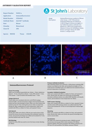 ANTIBODY VALIDATION REPORT
Report Number 96965-a
Application Immunofluorescence
Model Number STJ96965
Antibody Name Anti-Kif 7 antibody
Host Mouse
Clonality Monoclonal
Clone ID 3F8
Species MOUSE Tissue COLON
Image
Description
Immunofluorescence analysis of Mouse
colon tissue. 1: Kif 7 Monoclonal
Antibody(3F8)(red) was diluted at
1:200 (4 degree Celsius,overnight). 2:
Cy3 labled Secondary antibody was
diluted at 1:300 (room temperature,
50min).3: Picture B: DAPI(blue) 10min.
Picture A:Target. Picture B: DAPI.
Picture C: merge of A+B.
Primary Antibody Incubation
After blocking solution was removed a 1:200 primary antibody/PBS
solution was added on the slide, and incubated overnight at 4°C (a
small amount of distilled water was added into the incubation box to
prevent evaporation of antibody).
Secondary Antibody Incubation
slides were washed with PBS on a shaker for 5min, and repeated 3
times. Shortly after the slides were dried and corresponding
secondary antibody solution was added (HRP labelled), covering the
tissues, and incubated at room temperature for 50min.
DAPI Counter-Staining
slides were washed with PBS on a shaker for 5min, repeated 3 times
and then dried. DAPI staining solution was added inside the PAP
circles and incubated for 10 min at room temperature without light
exposure.
Mounting
Slides were washed with PBS on a shaker for 5min, and repeated 3
times. Shortly after slides were dried, anti-quench mountings were
used to mount slides.
Visualization
The slides were observed and placed under a NIKON inverted
fluorescence microscope (Ultra violet excitation 330-380nm,
emission 420nm; FITC green excitation 465-495nm, emission 515-
555 nm; CY3 red excitation 510-560nm, emission 590nm)
Immunofluorescence Protocol
Tissue Processing
Slides were incubated sequentially into: Xylene - 15min, Anhydrous
ethanol – 15 min, Anhydrous ethanol – 5 min, 85% alcohol – 5 min,
75% alcohol – 5 min & washed with distilled water – 5 min.
Antigen Retrieval
Tissue slides were incubated with citric acid (PH6.0) antigen
retrieval buffer, and microwaved for antigen retrieval (heated until
boiled and then stop heating) for 8min. Slides were then heated with
medium power for 7min. During this process slides are kept from
drying out. After cooling down at room temperature, slides were
washed with PBS on a shaker for 5min, and repeated 3 times.
Anti-Quench
shortly after slides were dried, a PAP pen was used to draw circles
around the tissues (to prevent draining of the antibody). Inside the
circles, anti-quench mountings were added and incubated for 5 min,
and then flushed with water for 10min.
BSA Blocking
Inside the circles, BSA was used to cover the tissue evenly, blocking
for 30min.
St John's Laboratory Ltd.
www.stjohnslabs.com
 