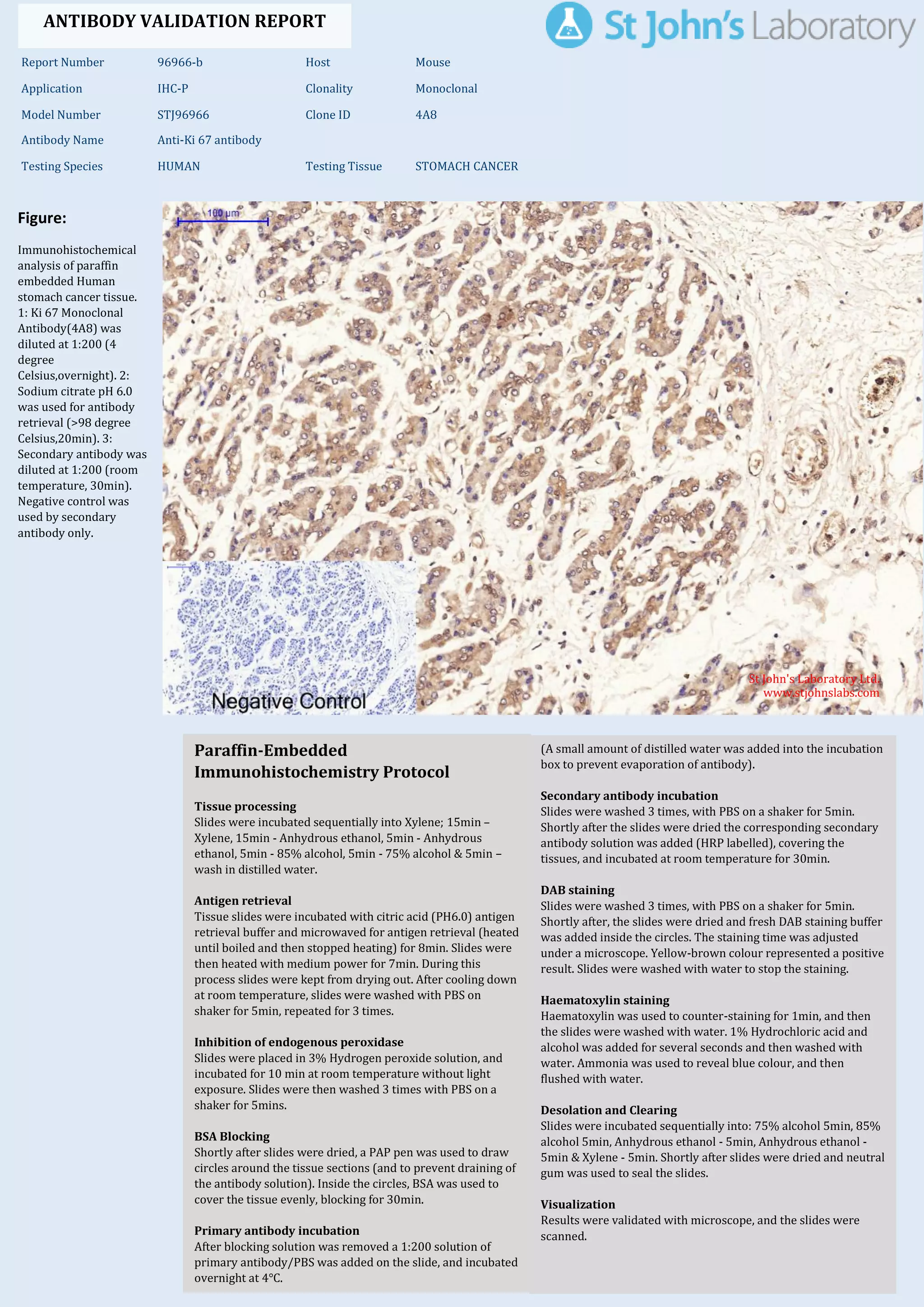 Ihc Validation Process Immunohistochemistry Antibody Validation Report for Anti-Ki 67 Antibody ...