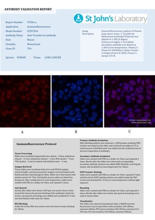 ANTIBODY VALIDATION REPORT
Report Number 97054-a
Application Immunofluorescence
Model Number STJ97054
Antibody Name Anti-Transferrin antibody
Host Mouse
Clonality Monoclonal
Clone ID 7F4
Species HUMAN Tissue LUNG CANCER
Image
Description
Immunofluorescence analysis of Human
lung cancer tissue. 1: Transferrin
Monoclonal Antibody(7F4)(red) was
diluted at 1:200 (4 degree
Celsius,overnight). 2: Cy3 labled
Secondary antibody was diluted at
1:300 (room temperature, 50min).3:
Picture B: DAPI(blue) 10min. Picture
A:Target. Picture B: DAPI. Picture C:
merge of A+B.
Primary Antibody Incubation
After blocking solution was removed a 1:200 primary antibody/PBS
solution was added on the slide, and incubated overnight at 4°C (a
small amount of distilled water was added into the incubation box to
prevent evaporation of antibody).
Secondary Antibody Incubation
slides were washed with PBS on a shaker for 5min, and repeated 3
times. Shortly after the slides were dried and corresponding
secondary antibody solution was added (HRP labelled), covering the
tissues, and incubated at room temperature for 50min.
DAPI Counter-Staining
slides were washed with PBS on a shaker for 5min, repeated 3 times
and then dried. DAPI staining solution was added inside the PAP
circles and incubated for 10 min at room temperature without light
exposure.
Mounting
Slides were washed with PBS on a shaker for 5min, and repeated 3
times. Shortly after slides were dried, anti-quench mountings were
used to mount slides.
Visualization
The slides were observed and placed under a NIKON inverted
fluorescence microscope (Ultra violet excitation 330-380nm,
emission 420nm; FITC green excitation 465-495nm, emission 515-
555 nm; CY3 red excitation 510-560nm, emission 590nm)
Immunofluorescence Protocol
Tissue Processing
Slides were incubated sequentially into: Xylene - 15min, Anhydrous
ethanol – 15 min, Anhydrous ethanol – 5 min, 85% alcohol – 5 min,
75% alcohol – 5 min & washed with distilled water – 5 min.
Antigen Retrieval
Tissue slides were incubated with citric acid (PH6.0) antigen
retrieval buffer, and microwaved for antigen retrieval (heated until
boiled and then stop heating) for 8min. Slides were then heated with
medium power for 7min. During this process slides are kept from
drying out. After cooling down at room temperature, slides were
washed with PBS on a shaker for 5min, and repeated 3 times.
Anti-Quench
shortly after slides were dried, a PAP pen was used to draw circles
around the tissues (to prevent draining of the antibody). Inside the
circles, anti-quench mountings were added and incubated for 5 min,
and then flushed with water for 10min.
BSA Blocking
Inside the circles, BSA was used to cover the tissue evenly, blocking
for 30min.
St John's Laboratory Ltd.
www.stjohnslabs.com
 