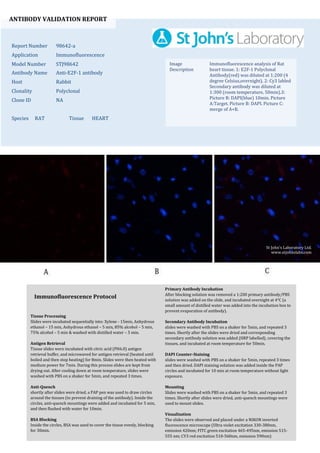 ANTIBODY VALIDATION REPORT
Report Number 98642-a
Application Immunofluorescence
Model Number STJ98642
Antibody Name Anti-E2F-1 antibody
Host Rabbit
Clonality Polyclonal
Clone ID NA
Species RAT Tissue HEART
Image
Description
Immunofluorescence analysis of Rat
heart tissue. 1: E2F-1 Polyclonal
Antibody(red) was diluted at 1:200 (4
degree Celsius,overnight). 2: Cy3 labled
Secondary antibody was diluted at
1:300 (room temperature, 50min).3:
Picture B: DAPI(blue) 10min. Picture
A:Target. Picture B: DAPI. Picture C:
merge of A+B.
Primary Antibody Incubation
After blocking solution was removed a 1:200 primary antibody/PBS
solution was added on the slide, and incubated overnight at 4°C (a
small amount of distilled water was added into the incubation box to
prevent evaporation of antibody).
Secondary Antibody Incubation
slides were washed with PBS on a shaker for 5min, and repeated 3
times. Shortly after the slides were dried and corresponding
secondary antibody solution was added (HRP labelled), covering the
tissues, and incubated at room temperature for 50min.
DAPI Counter-Staining
slides were washed with PBS on a shaker for 5min, repeated 3 times
and then dried. DAPI staining solution was added inside the PAP
circles and incubated for 10 min at room temperature without light
exposure.
Mounting
Slides were washed with PBS on a shaker for 5min, and repeated 3
times. Shortly after slides were dried, anti-quench mountings were
used to mount slides.
Visualization
The slides were observed and placed under a NIKON inverted
fluorescence microscope (Ultra violet excitation 330-380nm,
emission 420nm; FITC green excitation 465-495nm, emission 515-
555 nm; CY3 red excitation 510-560nm, emission 590nm)
Immunofluorescence Protocol
Tissue Processing
Slides were incubated sequentially into: Xylene - 15min, Anhydrous
ethanol – 15 min, Anhydrous ethanol – 5 min, 85% alcohol – 5 min,
75% alcohol – 5 min & washed with distilled water – 5 min.
Antigen Retrieval
Tissue slides were incubated with citric acid (PH6.0) antigen
retrieval buffer, and microwaved for antigen retrieval (heated until
boiled and then stop heating) for 8min. Slides were then heated with
medium power for 7min. During this process slides are kept from
drying out. After cooling down at room temperature, slides were
washed with PBS on a shaker for 5min, and repeated 3 times.
Anti-Quench
shortly after slides were dried, a PAP pen was used to draw circles
around the tissues (to prevent draining of the antibody). Inside the
circles, anti-quench mountings were added and incubated for 5 min,
and then flushed with water for 10min.
BSA Blocking
Inside the circles, BSA was used to cover the tissue evenly, blocking
for 30min.
St John's Laboratory Ltd.
www.stjohnslabs.com
 