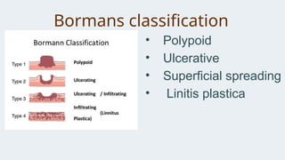 Boreman Classification Comprehensive Overview of Gastric Carcinoma: Diagnosis, Staging, and ...