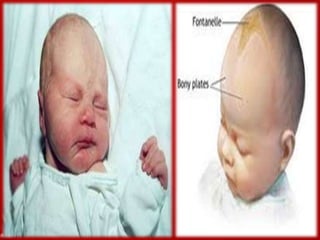 Süt çocuğunun büyüme ve geli̇şi̇mi̇