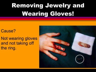 Removing Jewelry and Wearing Gloves! Cause? Not wearing gloves and not taking off the ring. 