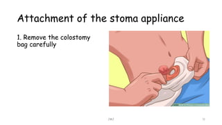 Attachment of the stoma appliance
JMJ 11
1. Remove the colostomy
bag carefully
 