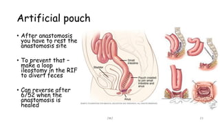 Artificial pouch
JMJ 23
• After anastomosis
you have to rest the
anastomosis site
• To prevent that –
make a loop
ileostomy in the RIF
to divert feces
• Can reverse after
6/52 when the
anastomosis is
healed
 