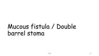 Mucous fistula / Double
barrel stoma
JMJ 26
 