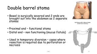 Double barrel stoma
• Bowel is surgically severed and 2 ends are
brought out into the abdomen as 2 separate
stomas
• Proximal end – functional stoma
• Distal end – non functioning (mucus fistula)
• Used in temporary diversion – cases where
resection is required due to perforation or
necrosis
JMJ 27
 