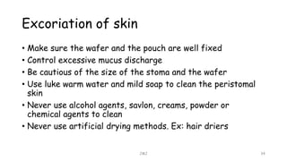 Excoriation of skin
• Make sure the wafer and the pouch are well fixed
• Control excessive mucus discharge
• Be cautious of the size of the stoma and the wafer
• Use luke warm water and mild soap to clean the peristomal
skin
• Never use alcohol agents, savlon, creams, powder or
chemical agents to clean
• Never use artificial drying methods. Ex: hair driers
JMJ 34
 