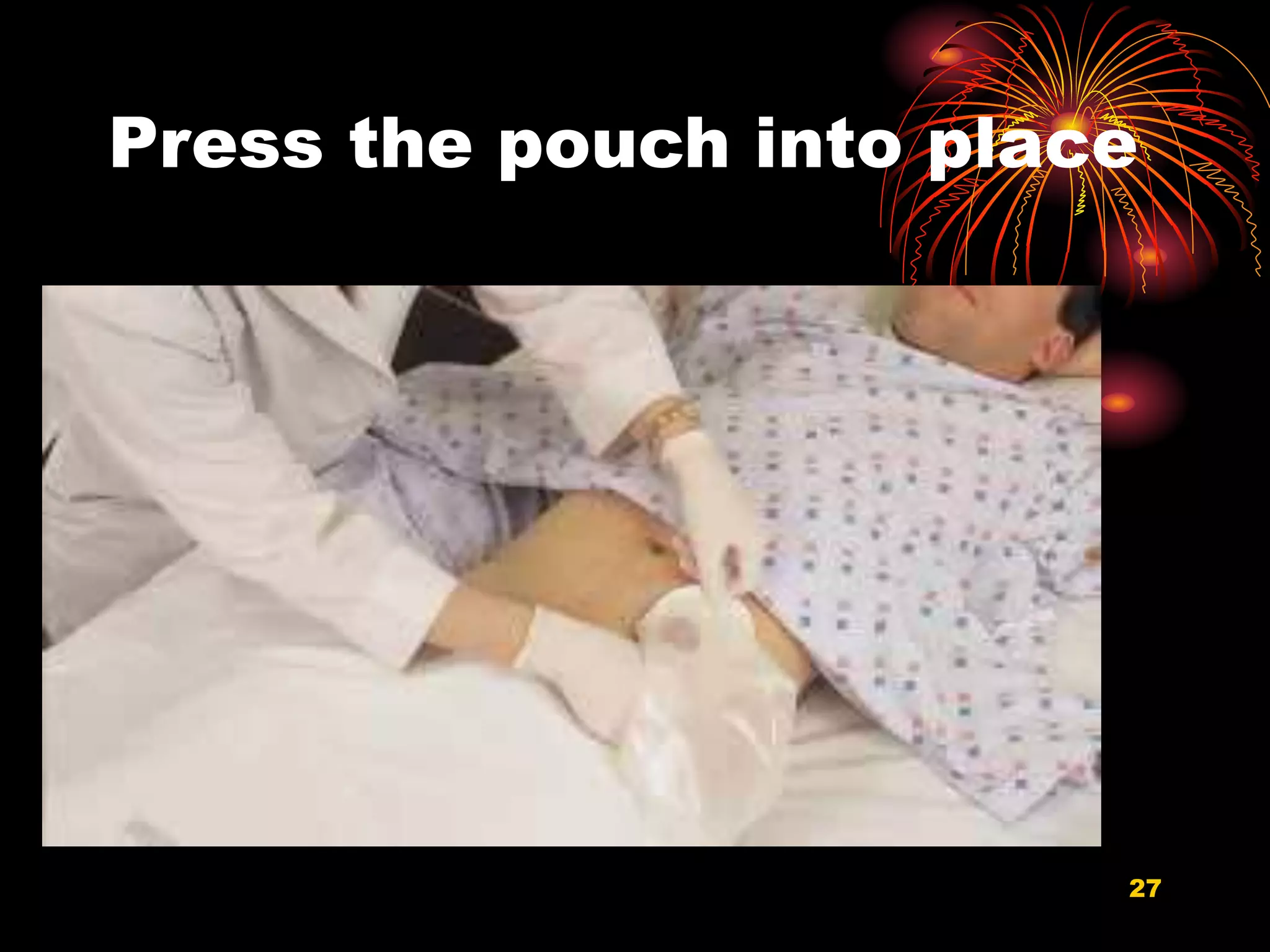 Press the pouch into place
27
 