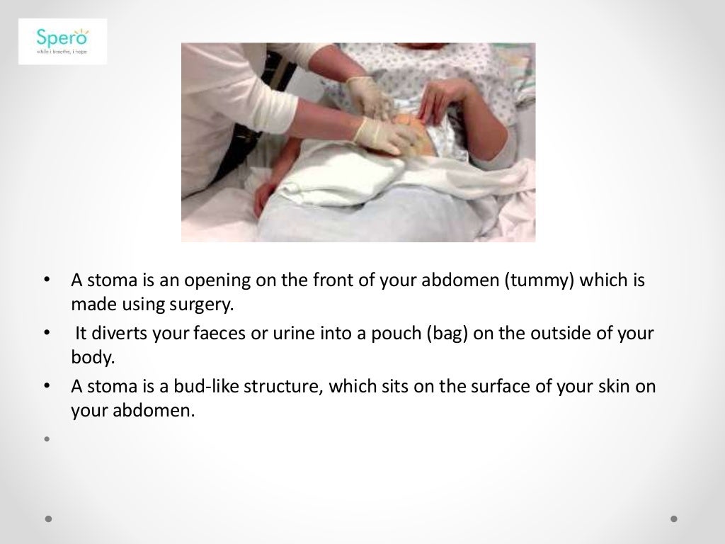 Stoma care
