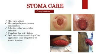 STOMA CARE
Complications
 Skin excoriations
 Mucosal prolapse—common
complication
 Infection either bacterial or
candidial
 Diarrhoea due to irritation.
 Leak due to improper fitting of the
appliances, scar, irregularity of
stoma, prolapse
 