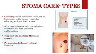 STOMA CARE- TYPES
Sites: occiput, scapula, ischium, sacrum, heel
 Colostomy—Colon at different levels, can be
brought out to the skin as required as
colostomy, to divert faecal matter
 All are end colostomy only. Loop colostomy
done for babies with ano-rectal
malformations
 Temporary end colostomy- Hartman’s
procedure
 Permanent end colostomy- after AP
Resection
 