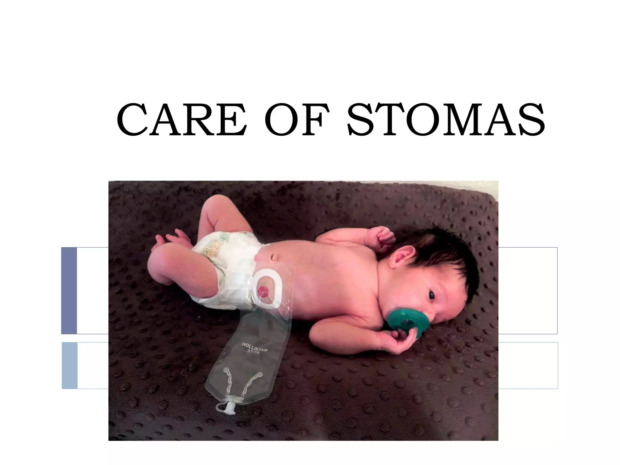 Stoma Inversion Stoma Care (1).ppt