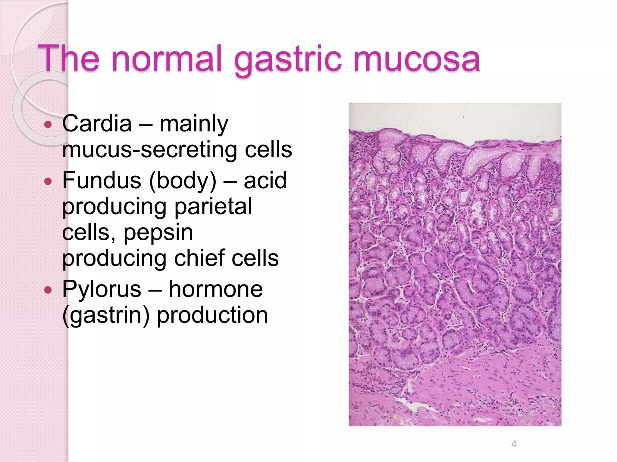 The normal gastric mucosa
 Cardia – mainly
mucus-secreting cells
 Fundus (body) – acid
producing parietal
cells, pepsin
producing chief cells
 Pylorus – hormone
(gastrin) production
4
 