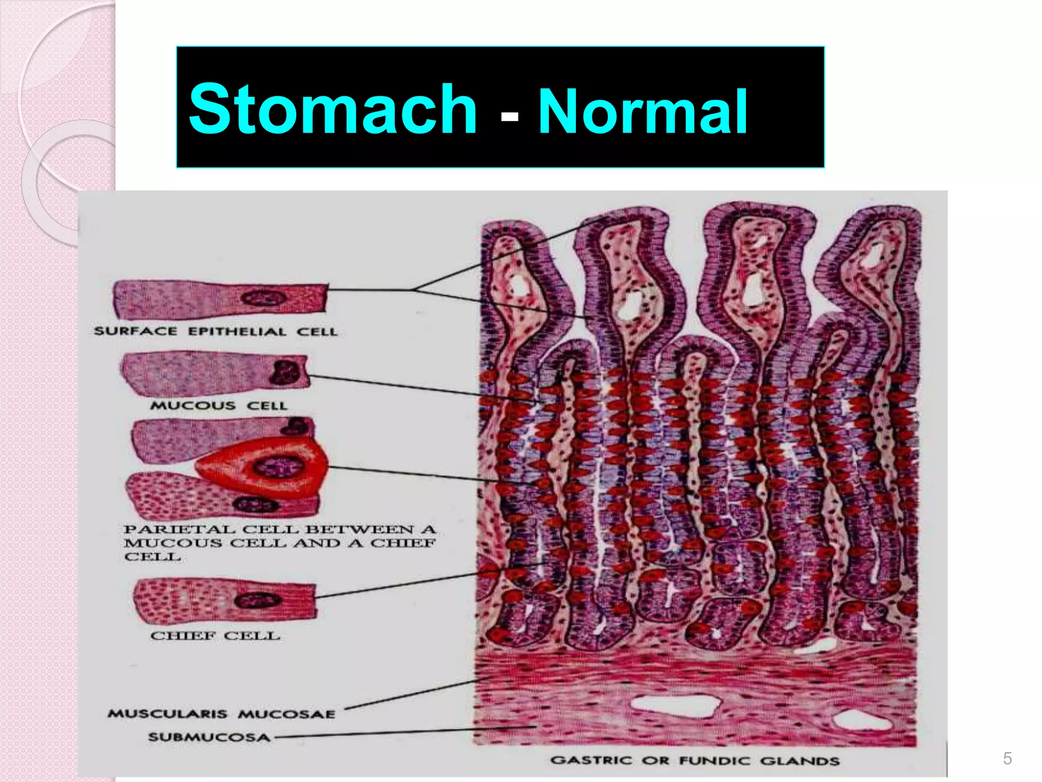 Stomach - Normal
5
 