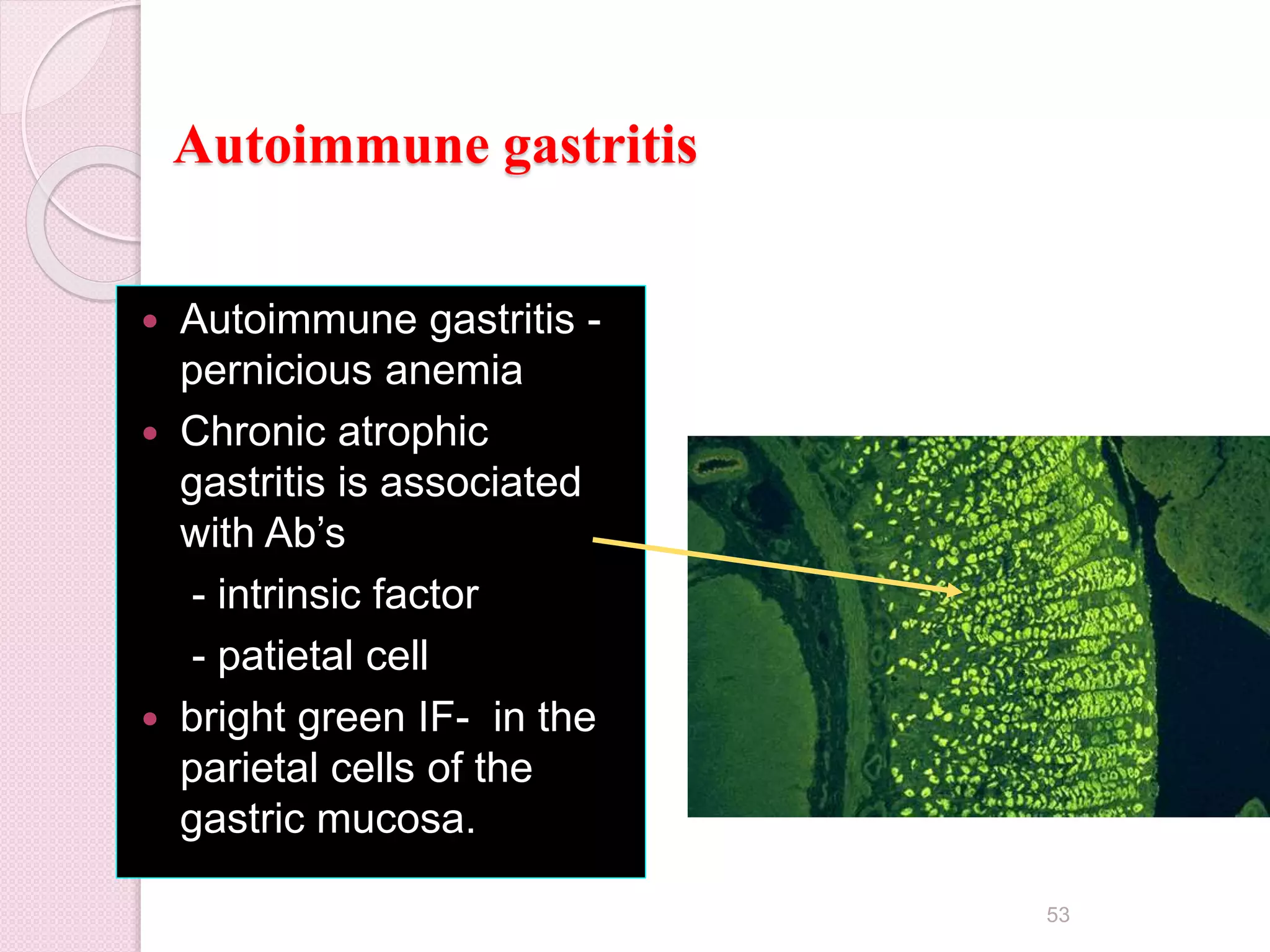 Autoimmune gastritis
 Autoimmune gastritis -
pernicious anemia
 Chronic atrophic
gastritis is associated
with Ab’s
- intrinsic factor
- patietal cell
 bright green IF- in the
parietal cells of the
gastric mucosa.
53
 
