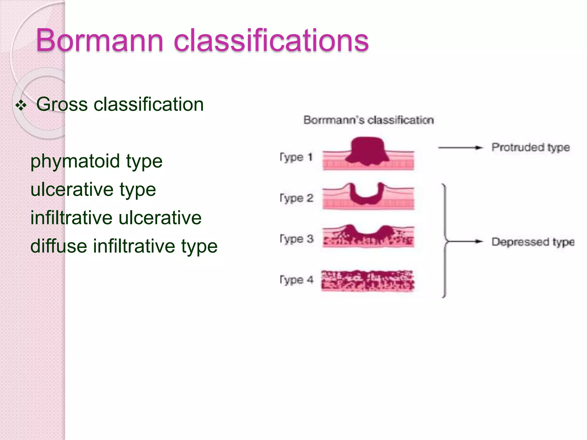 Bormann classifications
 Gross classification
phymatoid type
ulcerative type
infiltrative ulcerative
diffuse infiltrative type
 