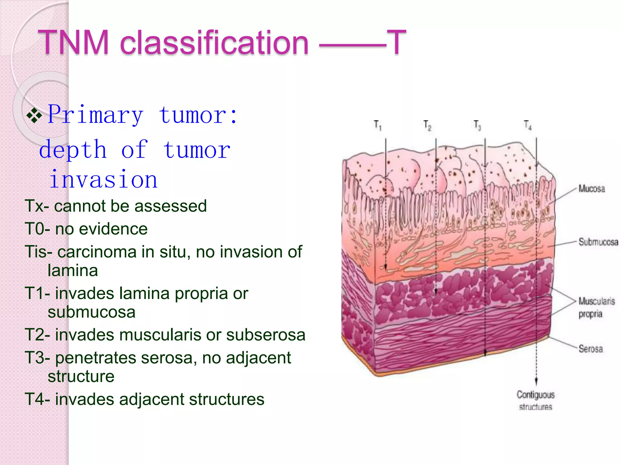 TNM classification ——T
 Primary tumor:
depth of tumor
invasion
Tx- cannot be assessed
T0- no evidence
Tis- carcinoma in situ, no invasion of
lamina
T1- invades lamina propria or
submucosa
T2- invades muscularis or subserosa
T3- penetrates serosa, no adjacent
structure
T4- invades adjacent structures
 